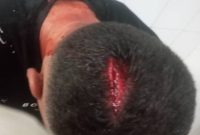 آسیب دیدگی  یکی از کارکنان شهرداری  درحین انجام ماموریت توسط دست فروشان