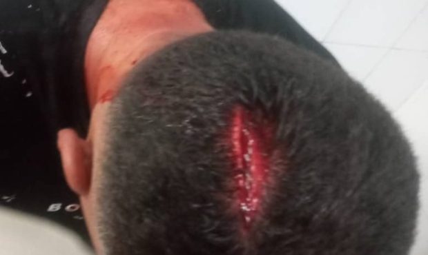 آسیب دیدگی  یکی از کارکنان شهرداری  درحین انجام ماموریت توسط دست فروشان